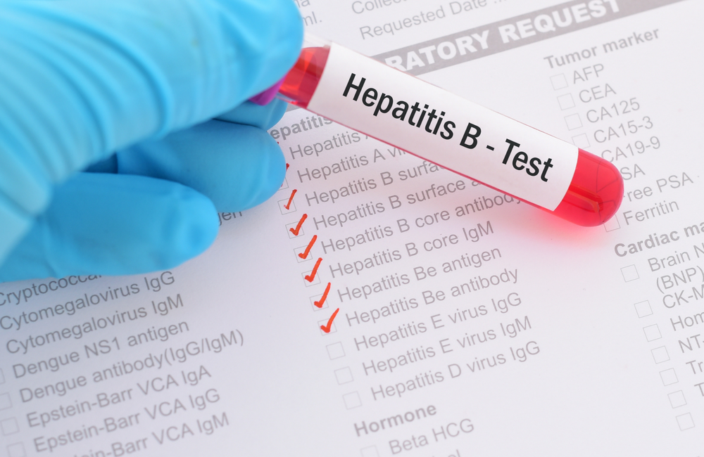 Hepatitis B | Aidsmap