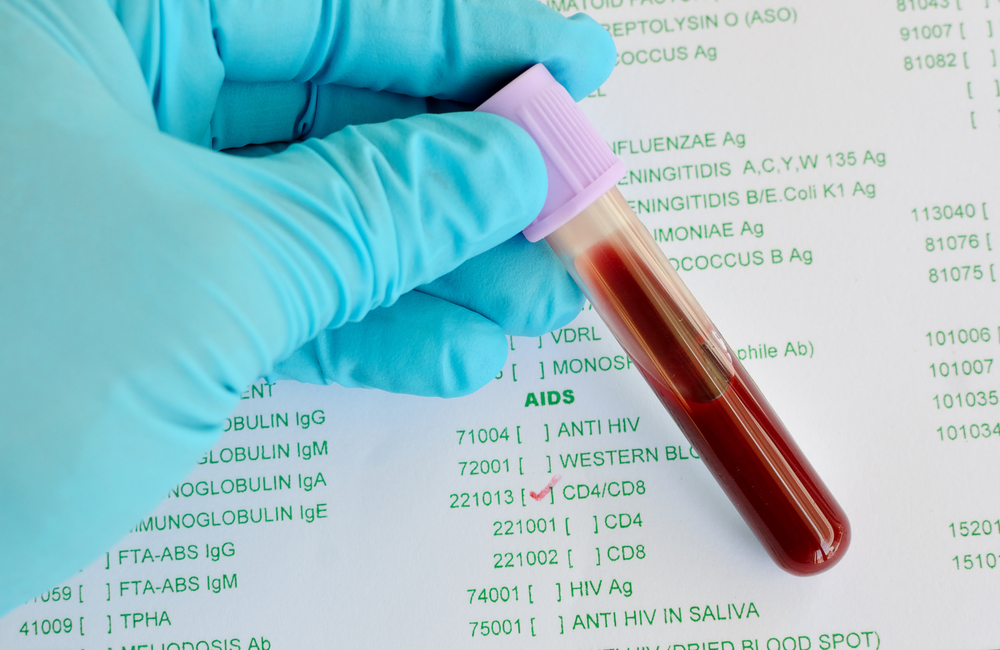 A person wearing a blue surgical glove holds a vial of blood in front of a bloodwork form. The option "CD4 CD8" is checked. The image has a pink and purple filter over it. 