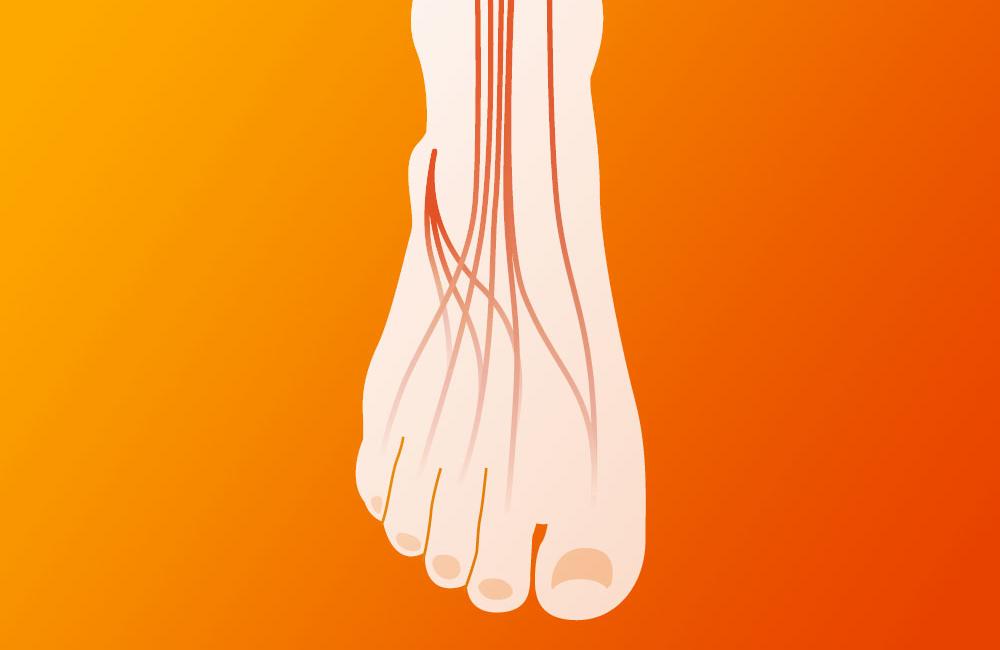 Peripheral Neuropathy: Diagnosis And Treatment | Aidsmap