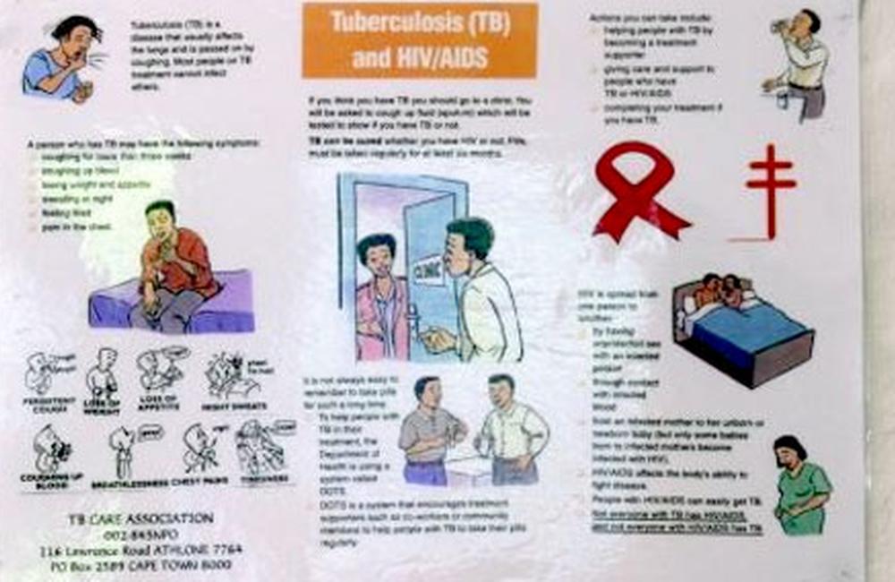 Нетворк спид. Tuberculosis, HIV (Human Immunodeficiency virus) infection and AIDS.