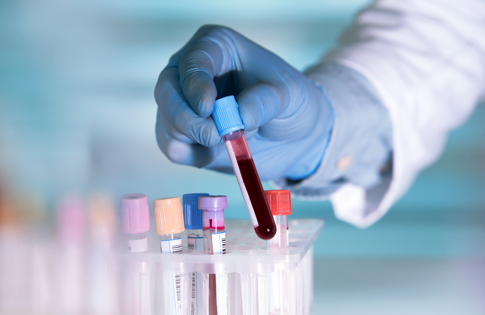 A close-up of somebody's hand. They are wearing blue surgical gloves and holding a vial that contains a small amount of blood. The image has a pink and purple filter over it.  