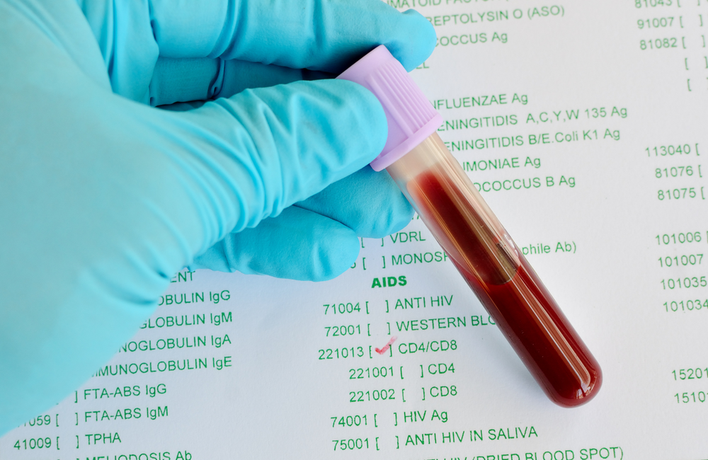 Cd4 Cd8 Ratio Aidsmap