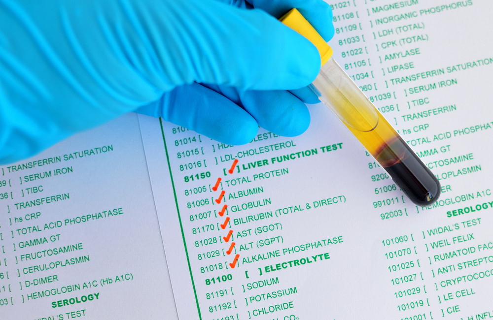 enlarged liver hepatitis