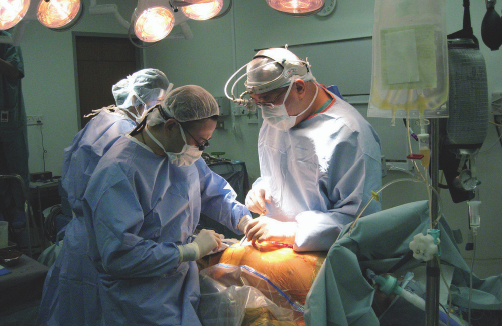 Liver transplant surgery