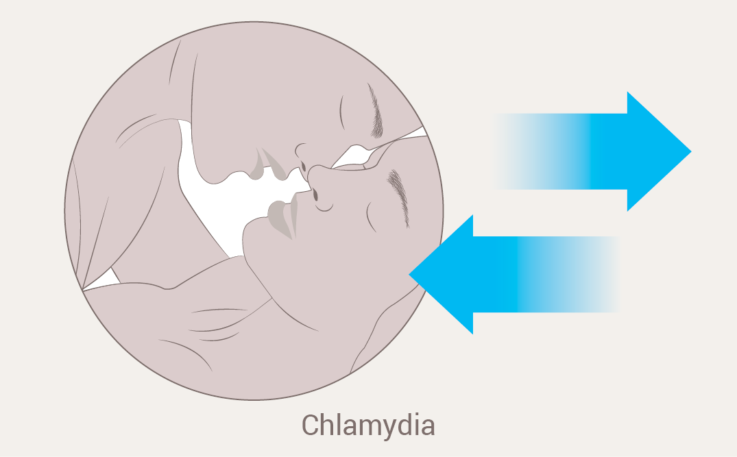 Hiv And Aids Information Factsheet Chlamydia